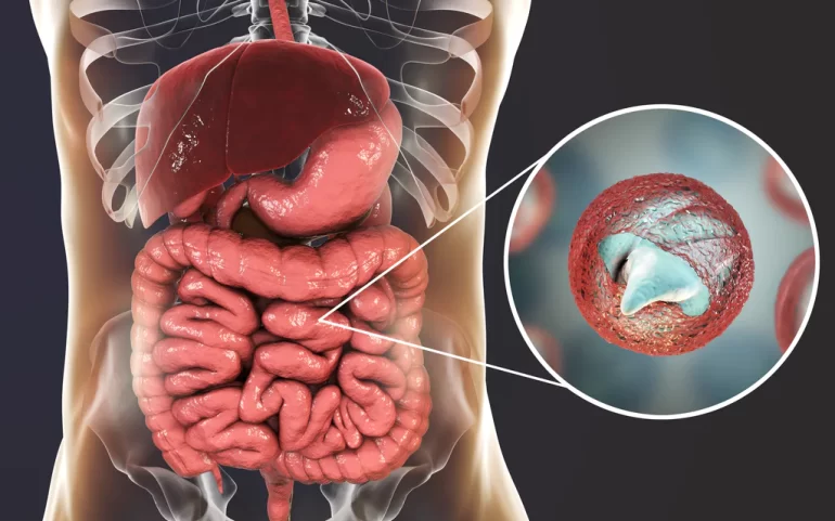 How Parasites Are Treated In Humans