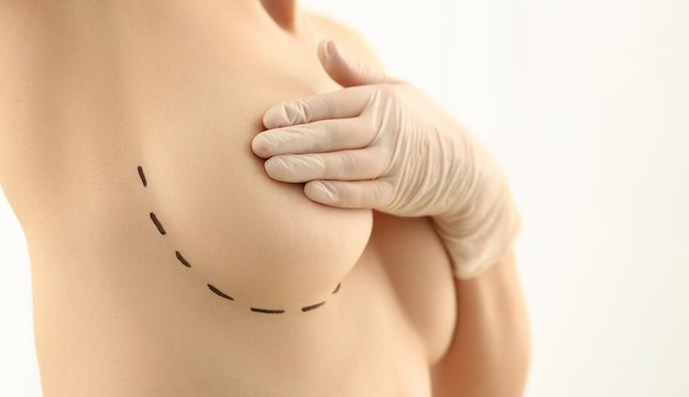 Uncovering the Secrets of Breast Lift