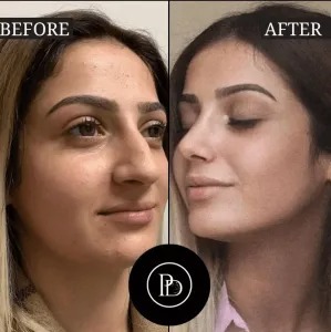 Choosing the Right Plastic Surgeon in Dubai – My Personal Tips